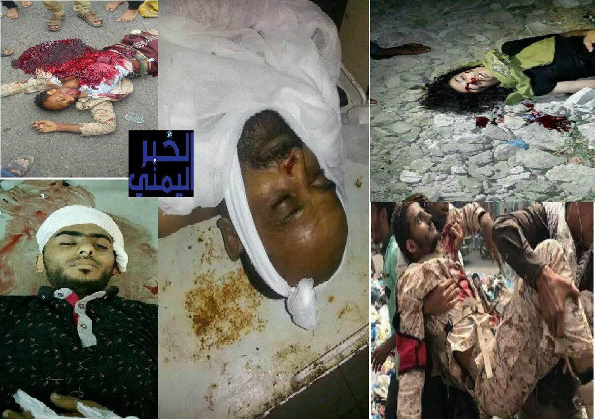 جنود الشرعية في مدينة تعز يدفعون ثمن صراع فصائلها..اغتيال الجندي السابع خلال أيام saudi